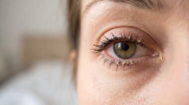 How to Prevent Crusty Eyes in the Morning