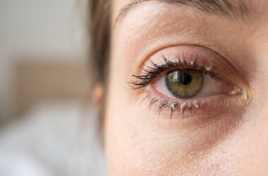 How to Prevent Crusty Eyes in the Morning