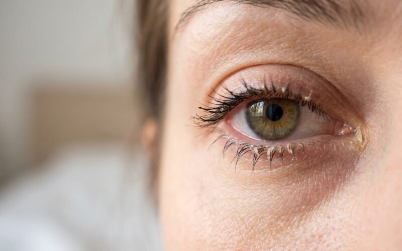 How to Prevent Crusty Eyes in the Morning